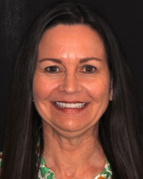 Dentistry of The Queen City patient dental results