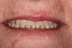 Main Gallery Image 3 | Smile Gallery