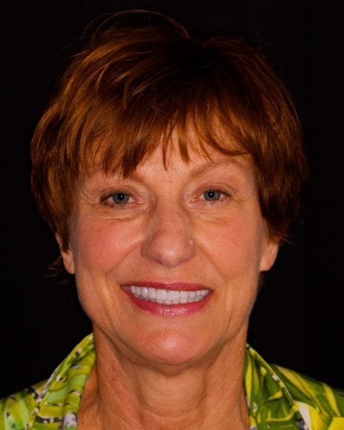 Dentistry of The Queen City patient dental results