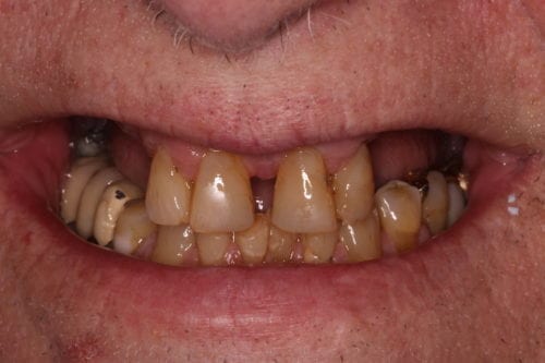 Before dentist treatment at Dentistry of The Queen City