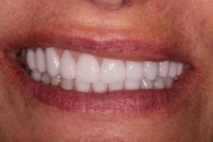 Main Gallery Image 4 | Smile Gallery