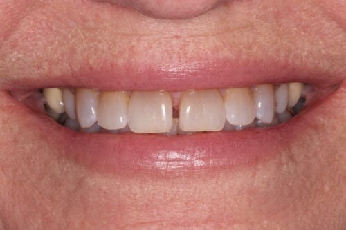 Before dentist treatment at Dentistry of The Queen City