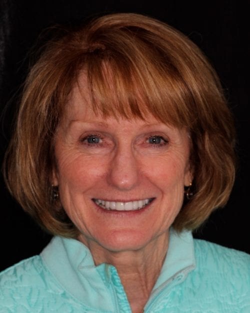 Dentistry of The Queen City patient dental results