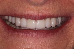 Main Gallery Image 7 | Smile Gallery