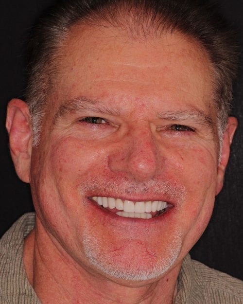 Dentistry of The Queen City patient dental results