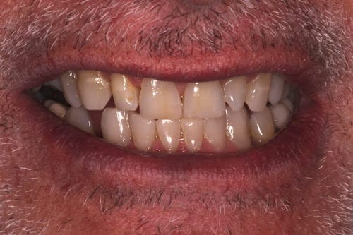 Before dentist treatment at Dentistry of The Queen City