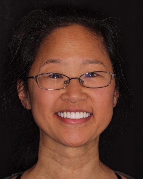 Dentistry of The Queen City patient dental results