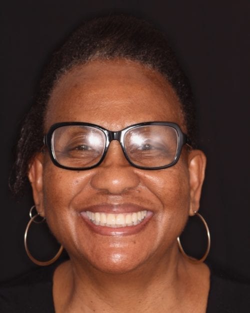 Dentistry of The Queen City patient dental results
