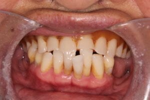 dentist in charlotte, nc