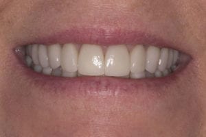 Main Gallery Image 12 | Smile Gallery