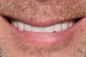 Main Gallery Image 18 | Smile Gallery