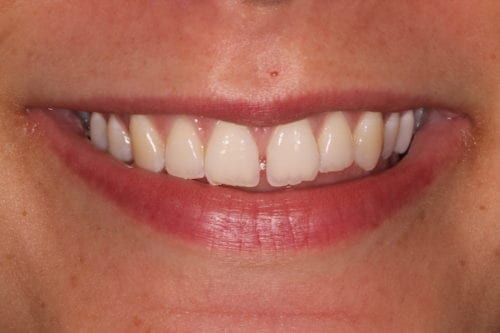 Before dentist treatment at Dentistry of The Queen City