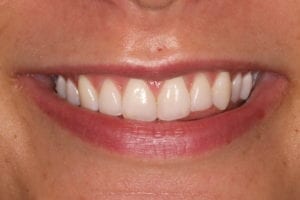Main Gallery Image 13 | Smile Gallery