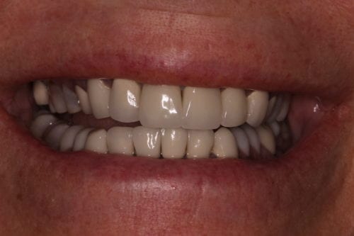 Before dentist treatment at Dentistry of The Queen City
