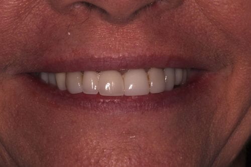 Before dentist treatment at Dentistry of The Queen City