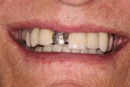 Before dentist treatment at Dentistry of The Queen City