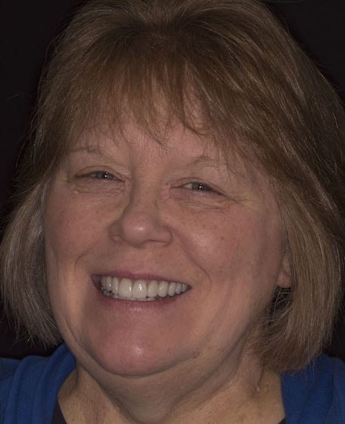Dentistry of The Queen City patient dental results