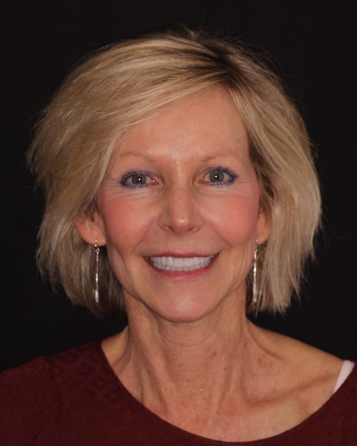 Dentistry of The Queen City patient dental results