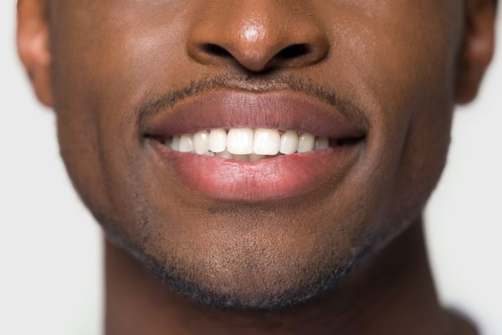 teeth whitening dentist charlotte nc