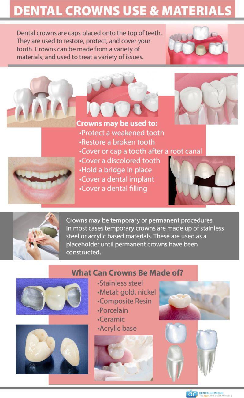dental crowns use and materials infographic