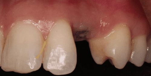 Before dentist treatment at Dentistry of The Queen City