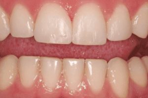 Main Gallery Image 20 | Smile Gallery