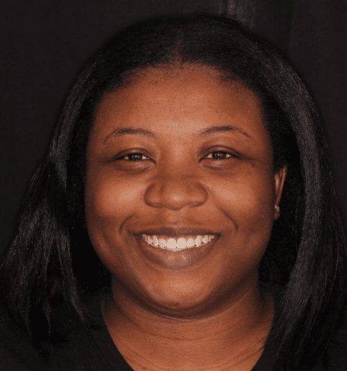 Dentistry of The Queen City patient dental results