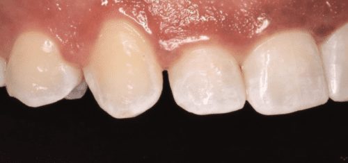 Before dentist treatment at Dentistry of The Queen City