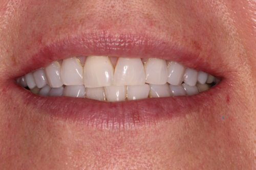 Before dentist treatment at Dentistry of The Queen City