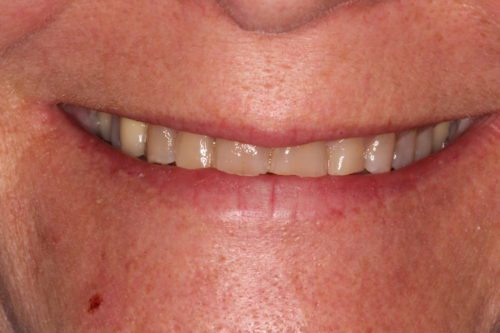 Before dentist treatment at Dentistry of The Queen City