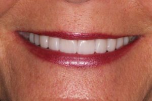 Main Gallery Image 22 | Smile Gallery