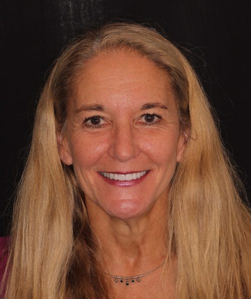 Dentistry of The Queen City patient dental results