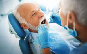 preventative dentistry after dental implant treatment