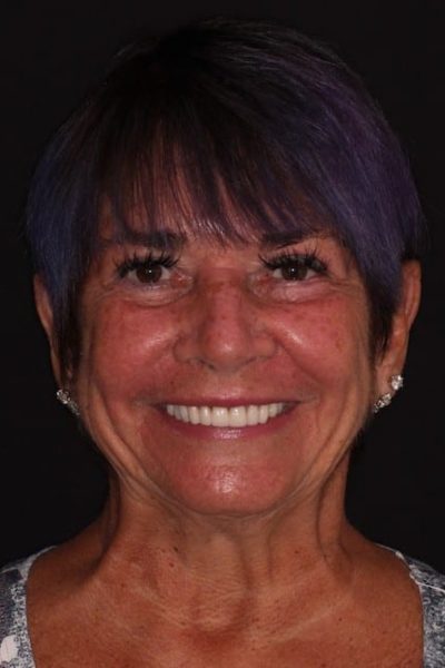 Results from dentistry at Coastal Cosmetic & Implant Dentistry