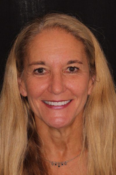 Results from dentistry at Coastal Cosmetic & Implant Dentistry