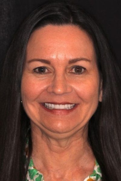 Results from dentistry at Coastal Cosmetic & Implant Dentistry