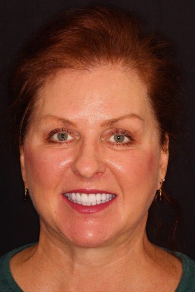 Results from dentistry at Coastal Cosmetic & Implant Dentistry