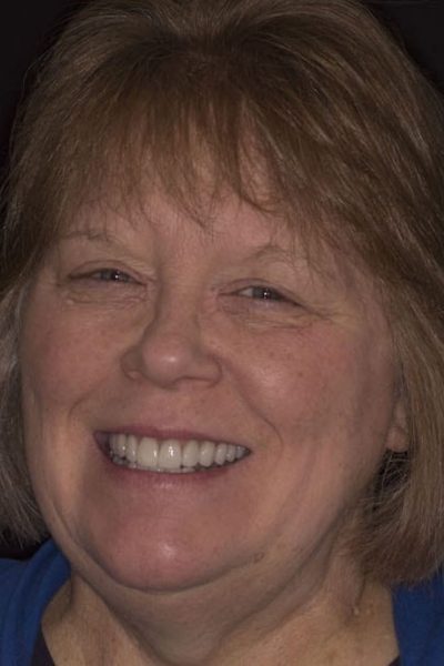 Results from dentistry at Coastal Cosmetic & Implant Dentistry