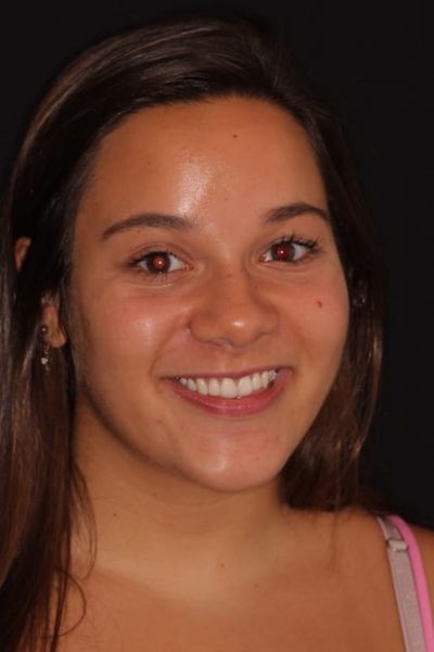 Results from dentistry at Coastal Cosmetic & Implant Dentistry