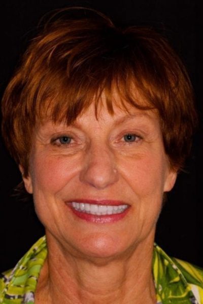 Results from dentistry at Coastal Cosmetic & Implant Dentistry