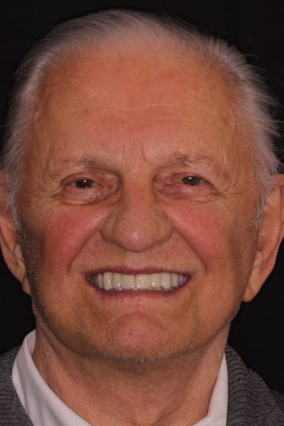 Results from dentistry at Coastal Cosmetic & Implant Dentistry