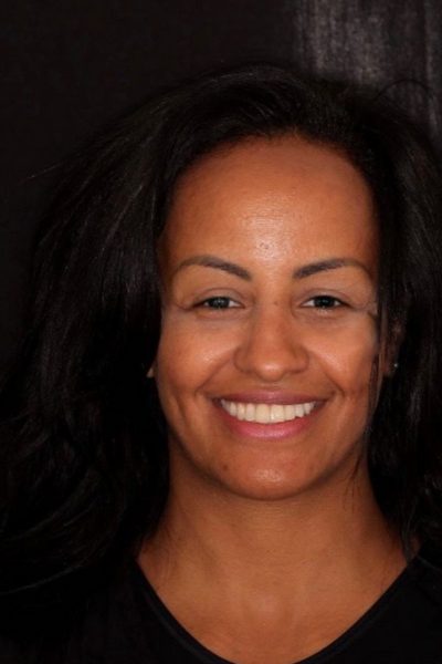 Results from dentistry at Coastal Cosmetic & Implant Dentistry