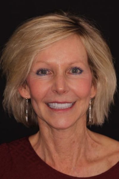 Results from dentistry at Coastal Cosmetic & Implant Dentistry