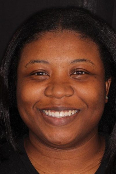 Hear from our satisified dental patients at Dentistry of the Queen City in Charlotte, NC