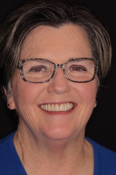 Results from dentistry at Coastal Cosmetic & Implant Dentistry