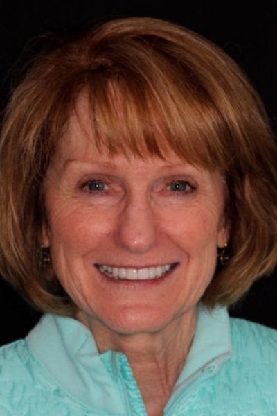 Results from dentistry at Coastal Cosmetic & Implant Dentistry