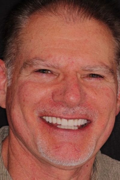 Results from dentistry at Coastal Cosmetic & Implant Dentistry