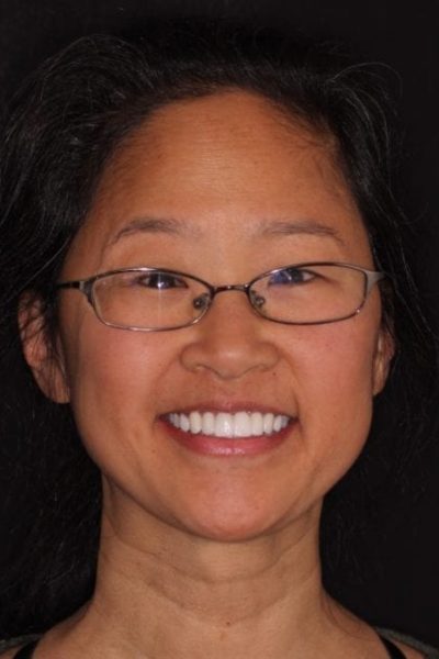 Results from dentistry at Coastal Cosmetic & Implant Dentistry