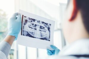 Do I Need an Annual Dental X-Ray