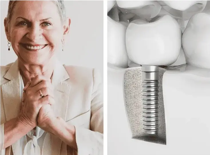 Advanced Solutions for Missing Teeth in Charlotte